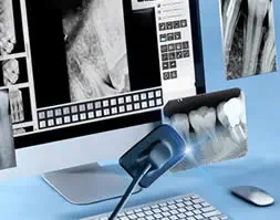 Digital X-Rays — high resolution with less radiation